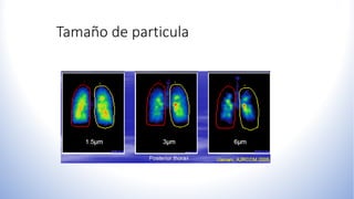 Tamaño de particula
 