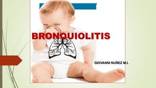 BRONQUIOLITIS
GIOVANNI NUÑEZ M.I.
 