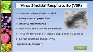 Bronquiolitis 1 | PPTX