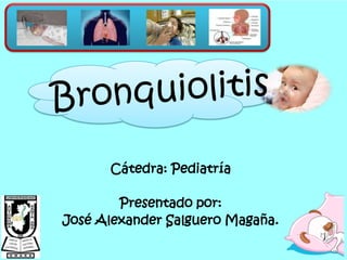 Bronquiolitis Cátedra: Pediatría Presentado por: José Alexander Salguero Magaña. 
