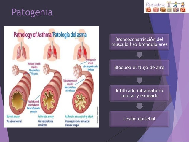Como distinguir la eccema de la dermatitis alérgica