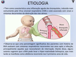 Tem como característica uma inflamação aguda dos bronquíolos, induzida mais
comumente pelo Vírus sincicial respiratório (VSR) e está associada com sinais e
sintomas decorrentes da obstrução das vias aéreas.
Observa-se que uma porcentagem significativa dos pacientes com história de
BVA evoluem com sintomas respiratórios recorrentes nos anos após a infecção,
principalmente aqueles que necessitaram de internação. Diante disso, alguns
autores sugerem que a BVA pode levar a hiper-reatividade brônquica, que mais
tarde se manifesta como sibilância recorrente nos 5 primeiros anos de vida.
Bronquiolo
inflamado
Muco
ETIOLOGIA
 