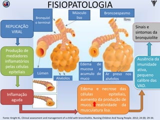 FISIOPATOLOGIA
REPLICAÇÃO
VIRAL
Produção de
mediadores
inflamatórios
pelas células
epiteliais
Inflamação
aguda
Edema e necrose das
células epiteliais,
aumento da produção de
muco, reatividade da
musculatura lisa.
Ausência da
imunidade
ativa,
pequeno
calibre das
VAD.
Sinais e
sintomas da
bronquiolite
Músculo
lisoBronquíol
o terminal
Lúmen
Alvéolos
Edema de
mucosa e
acumulo de
muco
Ar preso nos
alvéolos
Broncoespasmo
Fonte: Knight KL. Clinical assessment and management of a child with bronchiolitis. Nursing Children And Young People. 2012; 24 (8): 29-34.
 