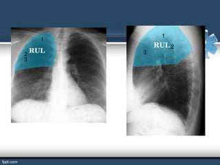 1
    1
                2
2       3
3
 