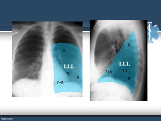 6
  6




               7+8   10
      10
           9              9
7+8
 