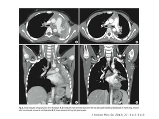 J Korean Med Sci 2012; 27: 1114-1119
 