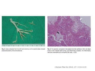 J Korean Med Sci 2012; 27: 1114-1119
 