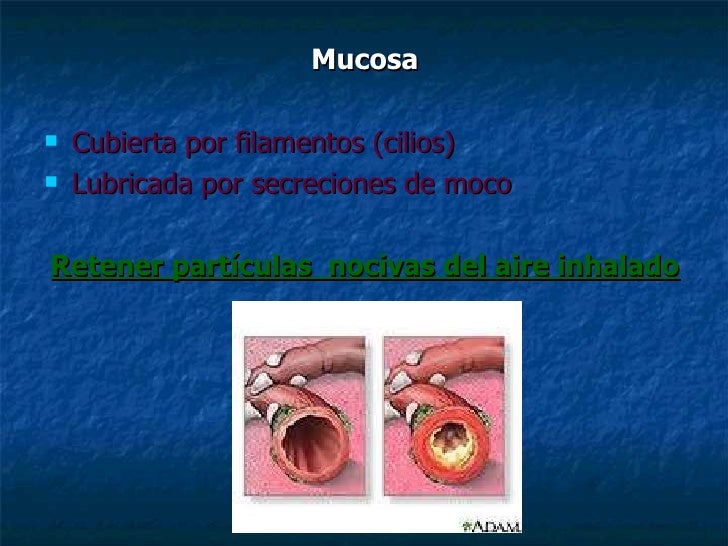 Bronquitis Bronquitis