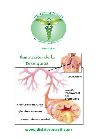 www.distripronavit.com
Bronquitis