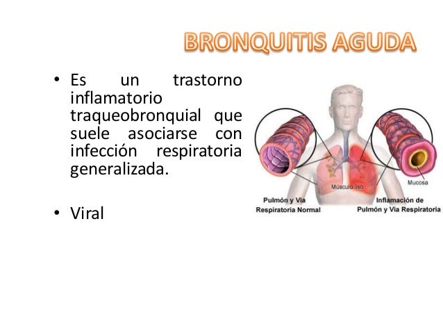 Bronquitis Y Bronquiolitis