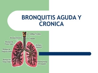 BRONQUITIS AGUDA Y
CRONICA
 