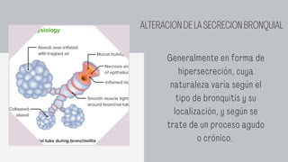 Bronquitis .pdf