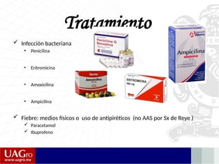  Infección bacteriana
• Penicilina
• Eritromicina
• Amoxicilina
• Ampicilina
 Fiebre: medios físicos o uso de antipiréticos (no AAS por Sx de Reye )
 Paracetamol
 Ibuprofeno
Tratamiento
 