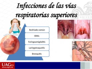 Infecciones de las vías
respiratorias superiores
Resfriado común
Otitis
Faringoamigdalitis
Laringotraqueitis
Bronquitis
 