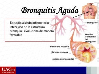 Episodio aislado inflamatorio-
infeccioso de la estructura
bronquial, evoluciona de manera
favorable
Bronquitis Aguda
 