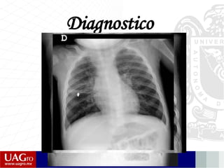 Diagnostico
 