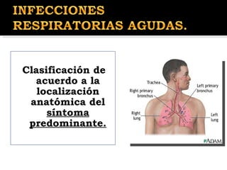Clasificación de acuerdo a la localización anatómica del  síntoma predominante. 