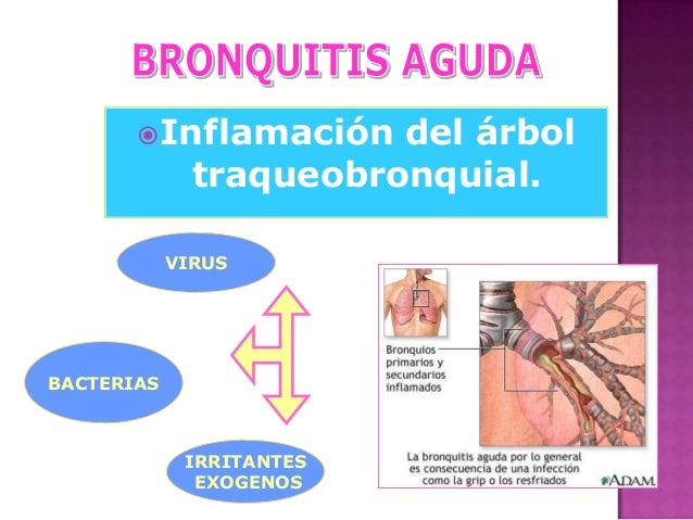La psoriasis de la piel de las manos la fase inicial