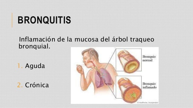 Bronquitis aguda y cronica