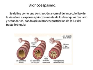 Broncoespasmo:
Se define como una contracción anormal del musculo liso de
la vía aérea a expensas principalmente de los bronquios terciario
y secundarios, dando así un broncoconstricción de la luz del
tracto bronquial
 