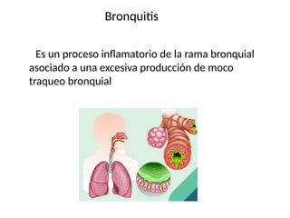 Es un proceso inflamatorio de la rama bronquial
asociado a una excesiva producción de moco
traqueo bronquial
Bronquitis
 