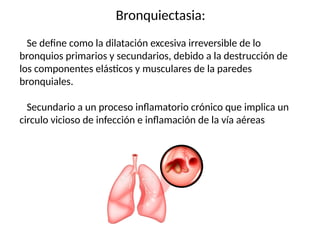Bronquiectasia:
Se define como la dilatación excesiva irreversible de lo
bronquios primarios y secundarios, debido a la destrucción de
los componentes elásticos y musculares de la paredes
bronquiales.
Secundario a un proceso inflamatorio crónico que implica un
circulo vicioso de infección e inflamación de la vía aéreas
 