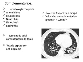 Complementarios:
 Hematología completa:
 Anemia leve
 Leucocitosis
 Neutrofilia
 Linfocitosis
 Eosinofilia
 Tomografía axial
computarizada de tórax
 Test de esputo con
antibiograma
 Proteína C reactiva: > 5mg/L
 Velocidad de sedimentación
globular: >10mm/h
 