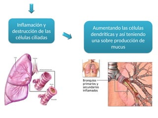 Inflamación y
destrucción de las
células ciliadas
Aumentando las células
dendríticas y así teniendo
una sobre producción de
mucus
 