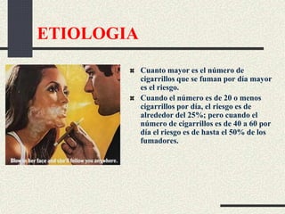 ETIOLOGIA
Cuanto mayor es el número de
cigarrillos que se fuman por día mayor
es el riesgo.
Cuando el número es de 20 o menos
cigarrillos por día, el riesgo es de
alrededor del 25%; pero cuando el
número de cigarrillos es de 40 a 60 por
día el riesgo es de hasta el 50% de los
fumadores.
 
