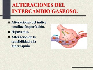 ALTERACIONES DEL
INTERCAMBIO GASEOSO.
Alteraciones del índice
ventilación/perfusión.
Hipoxemia.
Alteración de la
sensibilidad a la
hipercapnia
 