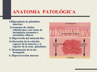 ANATOMIA PATOLÓGICA
1)Hiperplasia de glándulas
mucosas
2)Aumento de células
caliciformes, con zonas de
metaplasia escamosa y
anomalías ciliares.
3) Hipertrofia del músculo liso.
4)Alteración de la relación
espesor de la mucosa y el
espesor de la zona glandular.
5. Disminución de la luz
bronquial.
6. Hipersecreción mucosa
 