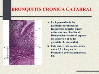 BRONQUITIS CRONICA CATARRAL
La hipertrofia de las
glándulas seromucosas
traqueobronquiales puede
estimarse con el índice de
Reid (cociente entre el espesor
de la pared y el de las
glándulas bronquiales)
Este índice esta normalmente
entre 0,2 a 0,4 y en la
bronquitis crónica aumenta a
0,6.
 