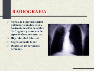 RADIOGRAFIA
 Signos de hiperinsuflación
pulmonar, con descenso y
horizontalización de ambos
diafragmas, y aumento del
espacio aéreo retrosternal
 Hiperclaridad bilateral
 Engrosamiento hiliar
 Dilatación de cavidades
derechas
 