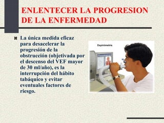 ENLENTECER LA PROGRESION
DE LA ENFERMEDAD
La única medida eficaz
para desacelerar la
progresión de la
obstrucción (objetivada por
el descenso del VEF mayor
de 30 ml/año), es la
interrupción del hábito
tabáquico y evitar
eventuales factores de
riesgo.
 