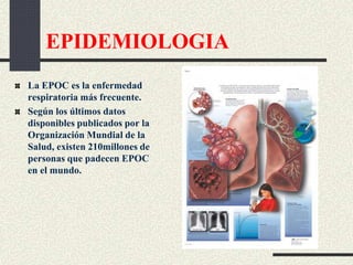EPIDEMIOLOGIA
La EPOC es la enfermedad
respiratoria más frecuente.
Según los últimos datos
disponibles publicados por la
Organización Mundial de la
Salud, existen 210millones de
personas que padecen EPOC
en el mundo.
 