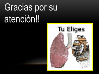 Gracias por su
atención!!
 
