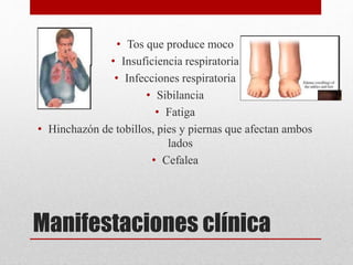 Manifestaciones clínica
• Tos que produce moco
• Insuficiencia respiratoria
• Infecciones respiratoria
• Sibilancia
• Fatiga
• Hinchazón de tobillos, pies y piernas que afectan ambos
lados
• Cefalea
 