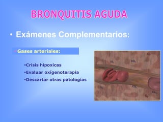 BRONQUITIS AGUDADiagnóstico:   Examen Físico:SDR , Disnea, Taquipnea, CianosisElasticidad sin alteracionesExpansibilidad en basesFrémito vocal Sonoridad normalBases desendidasMurmullo vesicularRoncus, Sibilancias, Estertores o Burbujas bilaterales.
