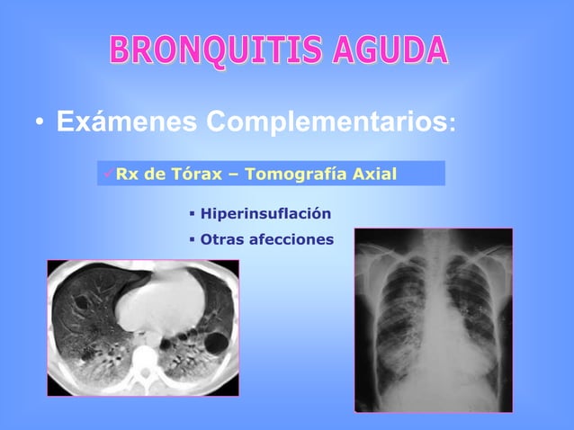 Bronquitis y asma 07 | PPTX