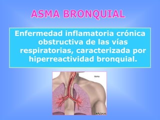 Otras alteracionesBRONQUITIS AGUDAExámenes Complementarios:Espirometría: