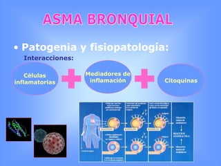  Otras afeccionesASMA BRONQUIALEnfermedad inflamatoria crónica obstructiva de las vías respiratorias, caracterizada por hiperreactividad bronquial.