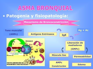 ASMA BRONQUIALEpidemiología y Etiología: