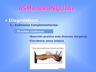 ASMA BRONQUIALEtiología y epidemiologíaMayor respuesta:   > Ventilación   < Humedad del aireEjercicioTensión EmocionalActividad vagalEndorfinas