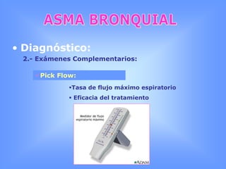 Hipertrofia glandular