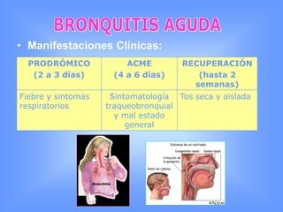 DiagnósticoBRONQUITIS AGUDAInflamación del árbol traqueobronquial.INFECCIOSOSFÍSICOSQUÍMICOS