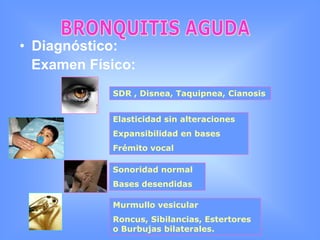 Fisiopatología:BRONQUITIS AGUDAInoculacióndirectaVírusAgente físico-químicoHipersensibilidadCitoquinasCelulas inflamatorias