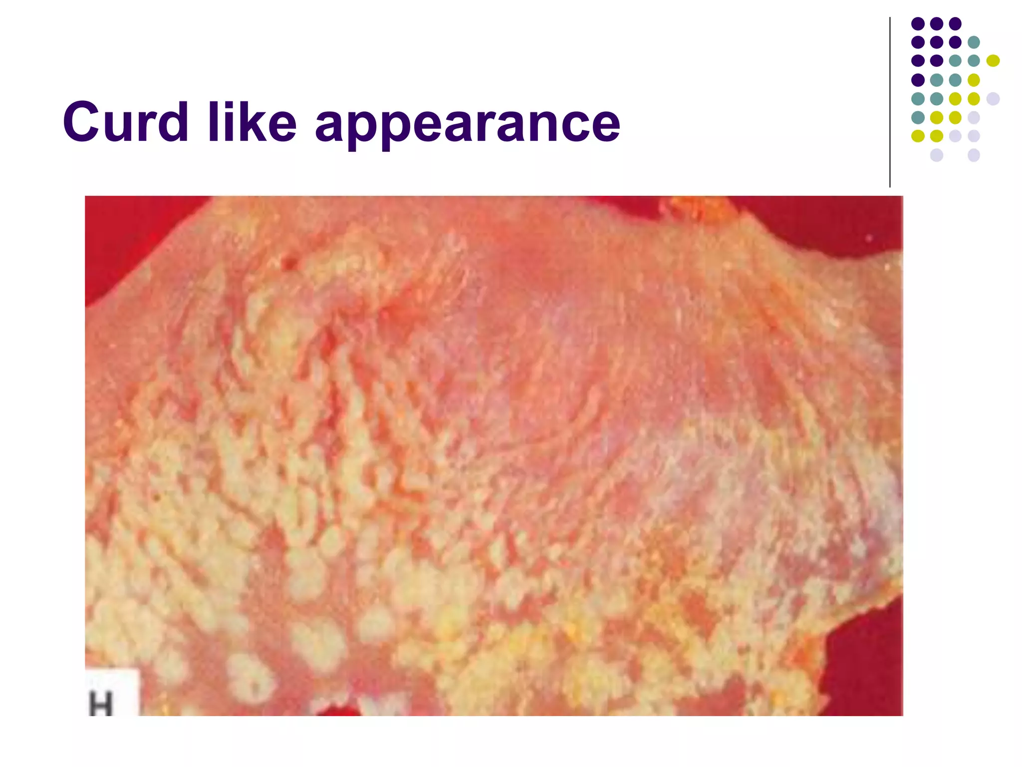 Brooder Pneumonia.ppt