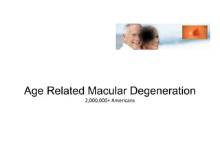 Age Related Macular Degeneration 
2,000,000+ Americans 
 