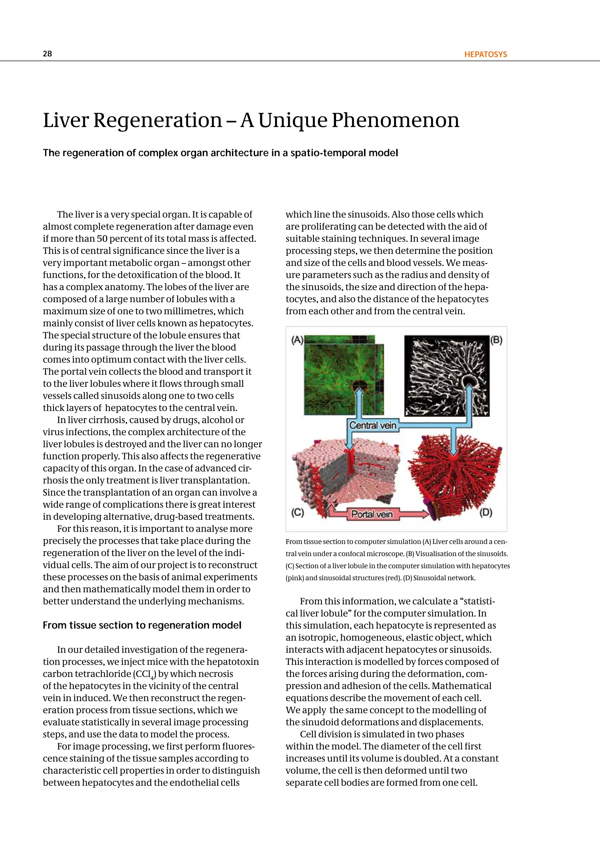 28                                                                                                                   hePatoSyS




Liver Regeneration – A Unique Phenomenon
the regeneration of complex organ architecture in a spatio-temporal model




    The liver is a very special organ. It is capable of   which line the sinusoids. Also those cells which
almost complete regeneration after damage even            are proliferating can be detected with the aid of
if more than 50 percent of its total mass is affected.    suitable staining techniques. In several image
This is of central significance since the liver is a      processing steps, we then determine the position
very important metabolic organ – amongst other            and size of the cells and blood vessels. We meas-
functions, for the detoxification of the blood. It        ure parameters such as the radius and density of
has a complex anatomy. The lobes of the liver are         the sinusoids, the size and direction of the hepa-
composed of a large number of lobules with a              tocytes, and also the distance of the hepatocytes
maximum size of one to two millimetres, which             from each other and from the central vein.
mainly consist of liver cells known as hepatocytes.
The special structure of the lobule ensures that
during its passage through the liver the blood
comes into optimum contact with the liver cells.
The portal vein collects the blood and transport it
to the liver lobules where it flows through small
vessels called sinusoids along one to two cells
thick layers of hepatocytes to the central vein.
    In liver cirrhosis, caused by drugs, alcohol or
virus infections, the complex architecture of the
liver lobules is destroyed and the liver can no longer
function properly. This also affects the regenerative
capacity of this organ. In the case of advanced cir-
rhosis the only treatment is liver transplantation.
Since the transplantation of an organ can involve a
wide range of complications there is great interest
in developing alternative, drug-based treatments.
    For this reason, it is important to analyse more
precisely the processes that take place during the        From tissue section to computer simulation (A) Liver cells around a cen-
regeneration of the liver on the level of the indi-       tral vein under a confocal microscope. (B) Visualisation of the sinusoids.
vidual cells. The aim of our project is to reconstruct    (C) Section of a liver lobule in the computer simulation with hepatocytes
these processes on the basis of animal experiments        (pink) and sinusoidal structures (red). (D) Sinusoidal network.
and then mathematically model them in order to
better understand the underlying mechanisms.                  From this information, we calculate a “statisti-
                                                          cal liver lobule” for the computer simulation. In
From tissue section to regeneration model                 this simulation, each hepatocyte is represented as
                                                          an isotropic, homogeneous, elastic object, which
    In our detailed investigation of the regenera-        interacts with adjacent hepatocytes or sinusoids.
tion processes, we inject mice with the hepatotoxin       This interaction is modelled by forces composed of
carbon tetrachloride (CCl4) by which necrosis             the forces arising during the deformation, com-
of the hepatocytes in the vicinity of the central         pression and adhesion of the cells. Mathematical
vein in induced. We then reconstruct the regen-           equations describe the movement of each cell.
eration process from tissue sections, which we            We apply the same concept to the modelling of
evaluate statistically in several image processing        the sinudoid deformations and displacements.
steps, and use the data to model the process.                 Cell division is simulated in two phases
    For image processing, we first perform fluores-       within the model. The diameter of the cell first
cence staining of the tissue samples according to         increases until its volume is doubled. At a constant
characteristic cell properties in order to distinguish    volume, the cell is then deformed until two
between hepatocytes and the endothelial cells             separate cell bodies are formed from one cell.
 