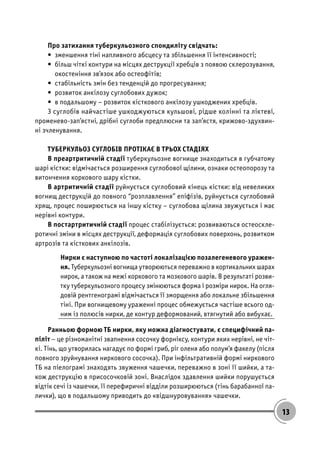 13
Про затихання туберкульозного спондиліту свідчать:
• зменшення тіні напливного абсцесу та збільшення її інтенсивності;
• більш чіткі контури на місцях деструкції хребців з появою склерозування,
окостеніння зв’язок або остеофітів;
• стабільність змін без тенденцій до прогресування;
• розвиток анкілозу суглобових дужок;
• в подальшому – розвиток кісткового анкілозу ушкоджених хребців.
З суглобів найчастіше ушкоджуються кульшові, рідше колінні та ліктеві,
променево-зап’ястні, дрібні суглоби предплюсни та зап’ястя, крижово-здухвин-
ні зчленування.
ТУБЕРКУЛЬОЗ СУГЛОБІВ ПРОТІКАЄ В ТРЬОХ СТАДІЯХ
В преартритичній стадії туберкульозне вогнище знаходиться в губчатому
шарі кістки: відмічається розширення суглобової щілини, ознаки остеопорозу та
витончення коркового шару кістки.
В артритичній стадії руйнується суглобовий кінець кістки: від невеликих
вогнищ деструкцій до повного “розплавлення” епіфізів, руйнується суглобовий
хрящ, процес поширюється на іншу кістку – суглобова щілина звужується і має
нерівні контури.
В постартритичній стадії процес стабілізується: розвиваються остеоскле-
ротичні зміни в місцях деструкції, деформація суглобових поверхонь, розвитком
артрозів та кісткових анкілозів.
Нирки є наступною по частоті локалізацією позалегеневого уражен-
ня. Туберкульозні вогнища утворюються переважно в кортикальних шарах
нирок, а також на межі коркового та мозкового шарів. В результаті розви-
тку туберкульозного процесу змінюються форма і розміри нирок. На огля-
довій рентгенограмі відмічається її зморщення або локальне збільшення
тіні. При вогнищевому ураженні процес обмежується частіше всього од-
ним із полюсів нирки, де контур деформований, втягнутий або вибухає.
Ранньою формою ТБ нирки, яку можна діагностувати, є специфічний па-
піліт – це різноманітні звапнення сосочку форніксу, контури яких нерівні, не чіт-
кі. Тінь, що утворилась нагадує по формі гриб, ріг оленя або полум’я факелу (після
повного зруйнування ниркового сосочка). При інфільтративній формі ниркового
ТБ на піелограмі знаходять звуження чашечки, переважно в зоні її шийки, а та-
кож деструкцію в присосочковій зоні. Внаслідок здавлення шийки порушується
відтік сечі із чашечки, її перефиричні відділи розширюються (тінь барабанної па-
лички), що в подальшому приводить до «відшнуровування» чашечки.
 